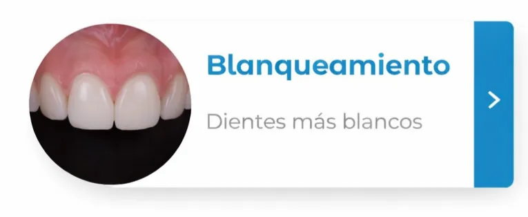 blanqueamiento dental