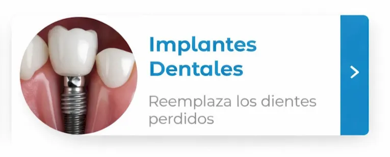 implantes dentales